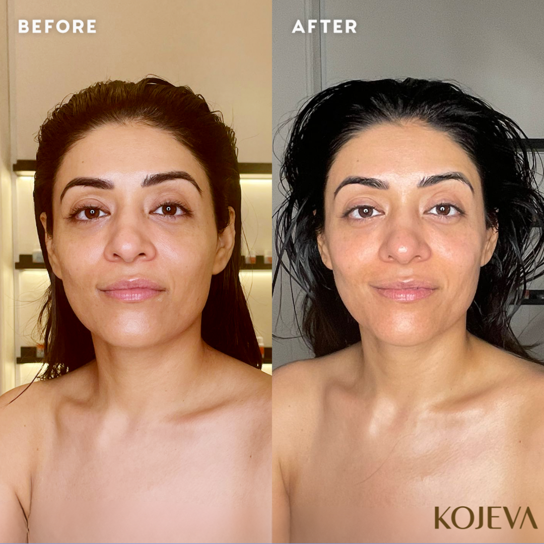 Customer using the Kojeva lymphatic face brush 3